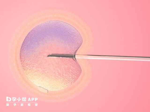 每一代试管技术都无可替代