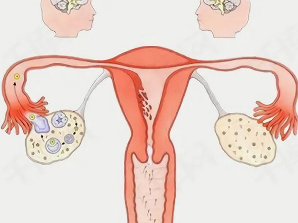AMH0.01代表卵巢功能不好