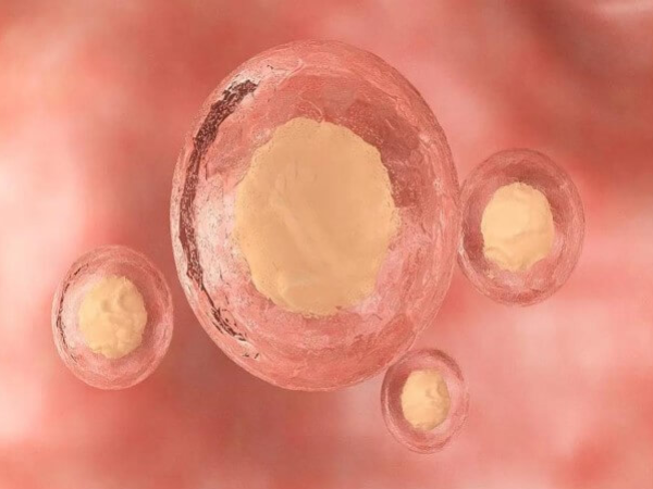 44岁促排3-5个卵泡属于正常